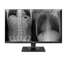 LG ELECTRONICS  27HJ713C-B  13473431                 Clinical Monitor, 27