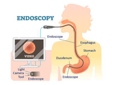 Endoscopes: Exploring Hidden Spaces with Advanced Video Technology